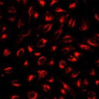 溶酶体免疫荧光法