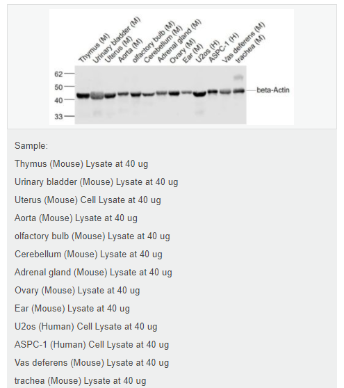 β-肌动蛋白/β-Actin（内参）抗体