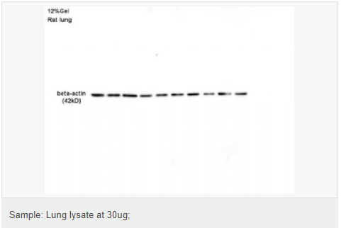 β-肌动蛋白/β-Actin（内参）抗体