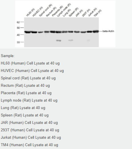β-肌动蛋白/β-Actin（内参）抗体