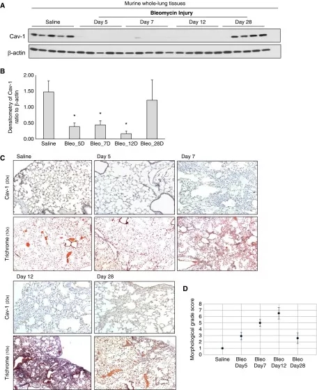 Cav1基因敲除小鼠与特发性肺纤维化