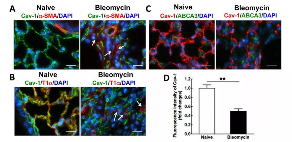 Cav1基因敲除小鼠与特发性肺纤维化