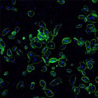 免疫荧光（石蜡-单标）