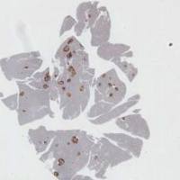 病理定量/阳性率分析