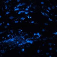 免疫荧光（冰冻-单标）