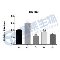 CircRNA RT-qPCR检测