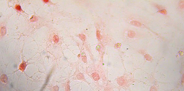 探讨免疫学IHC、ELISA和WB三大工具的区别