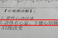 20 载烟酒沉醉耗尽 36 岁青年人生