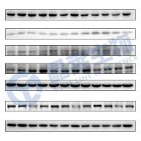 WB验证外泌体靶蛋白