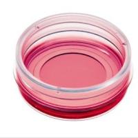德国ibidi µ-Dish 35 mm培养皿-81156 81151 80136 80131 80137 81158 81150