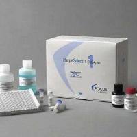 人鲍曼不动杆菌IgM抗体ELSIA试剂盒