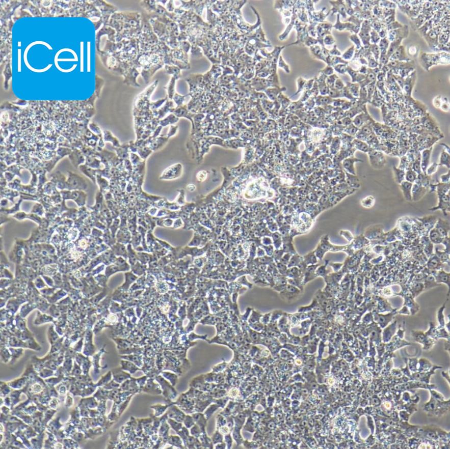 CBRH7919 大鼠肝癌细胞/STR鉴定/镜像绮点（Cellverse）