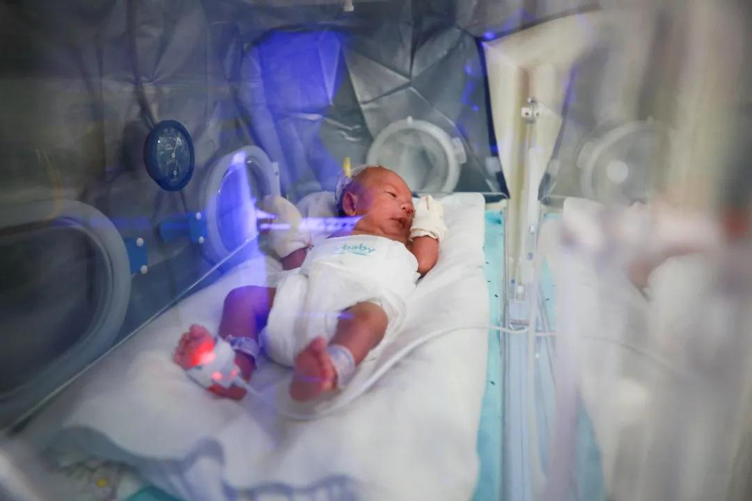 不足3斤早产儿成功抢救,健康出院