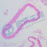 动脉粥样硬化(AS)动物模型/心脑血管模型