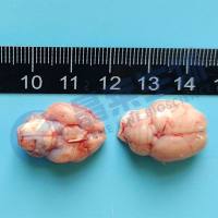 栓塞性脑梗死模型