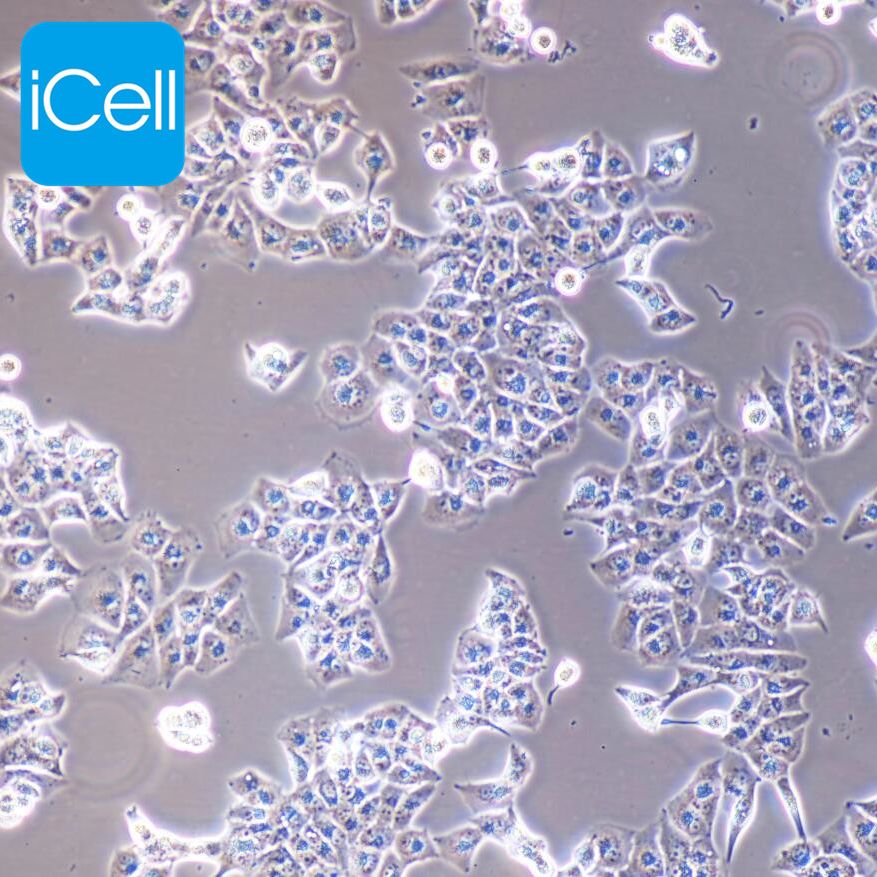 MHCC-97L 人低转移性肝癌细胞 STR鉴定 镜像绮点（Cellverse）
