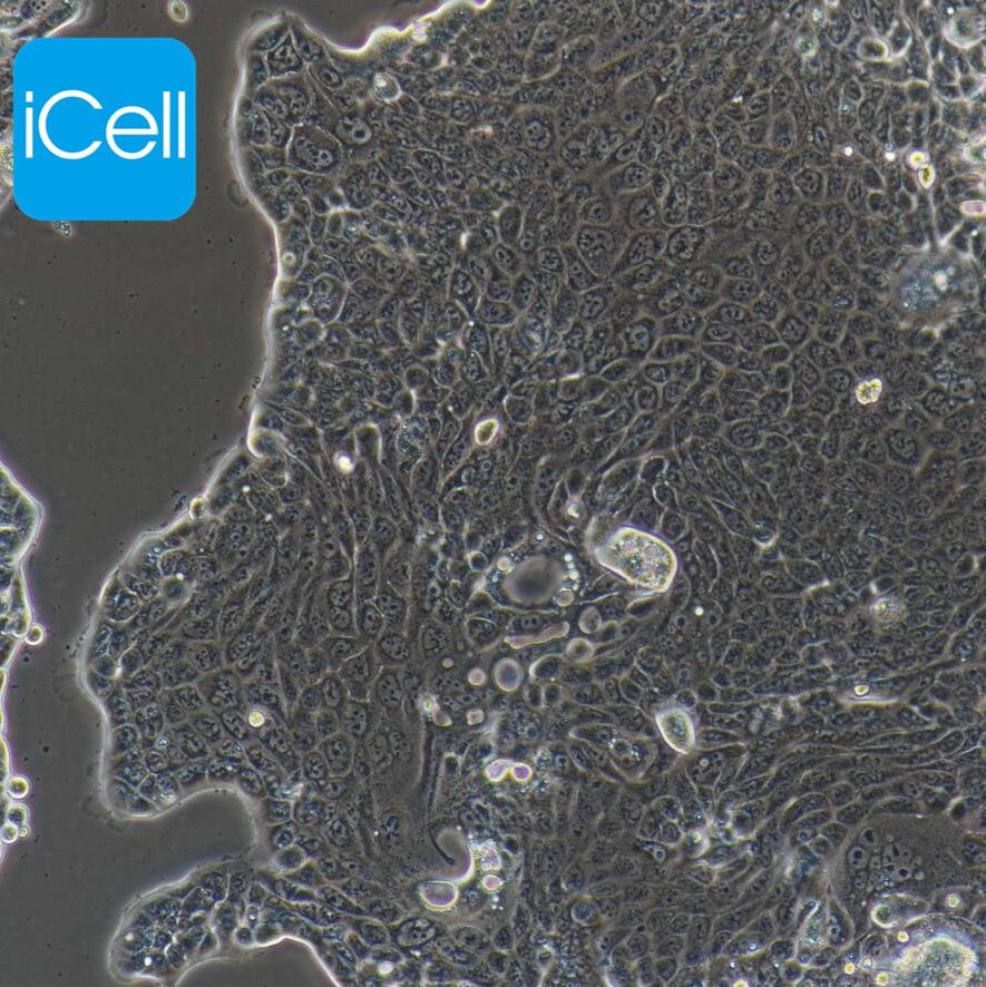 Calu-3 人肺腺癌细胞/STR鉴定/镜像绮点（Cellverse）