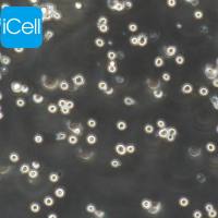 U87MG+luc |U87MG/luc|U87MG/luc细胞|人脑星形胶质母细胞瘤稳定表达荧光素酶