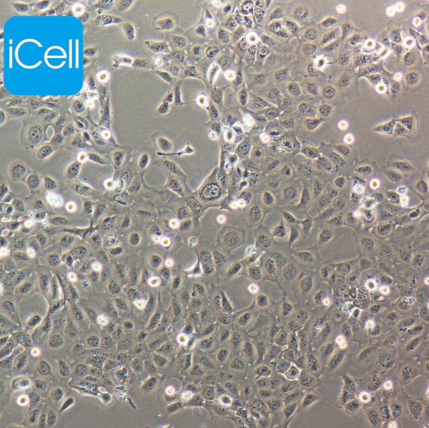 CASKI 人宫颈癌细胞 STR鉴定 镜像绮点（Cellverse）