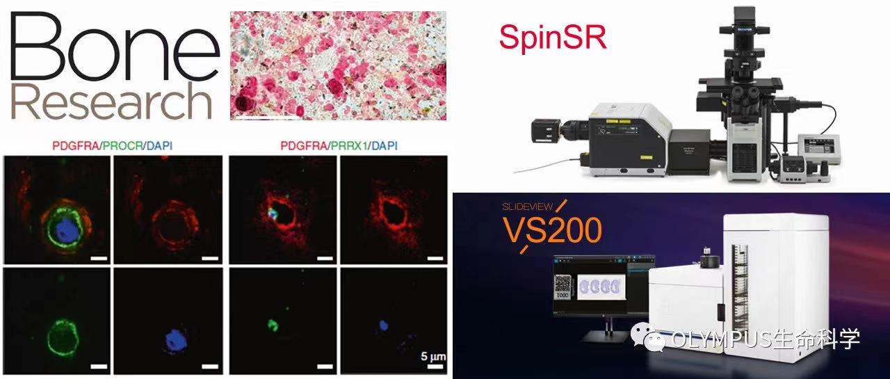 奥林巴斯助力绘制全球首.个椎间盘单细胞转录组图谱