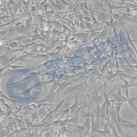 大鼠胚胎心肌细胞 H9c2(2-1)