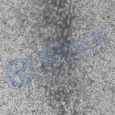 滋养细胞系-HRT-8-Svneo