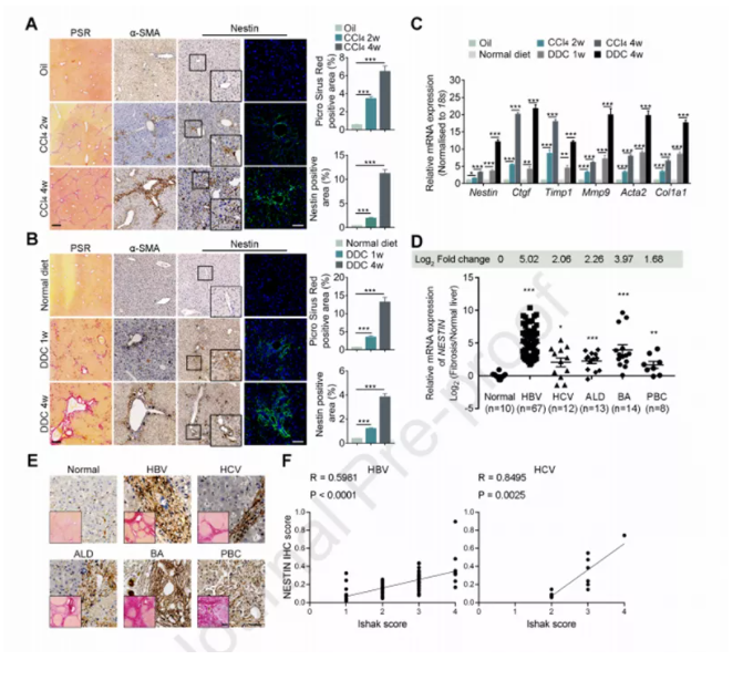 J HEPATOL：肝纤维化研究进展