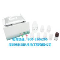 JE-乙脑病毒IgM检测试剂盒