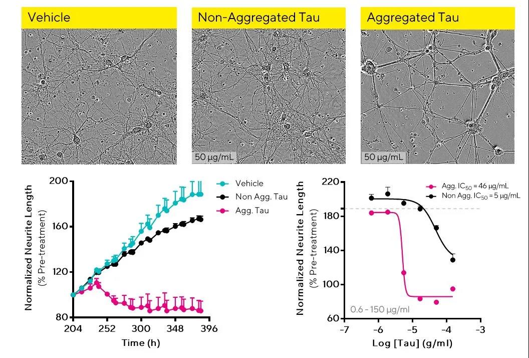 干货分享 | 神经细胞表型分析必读
