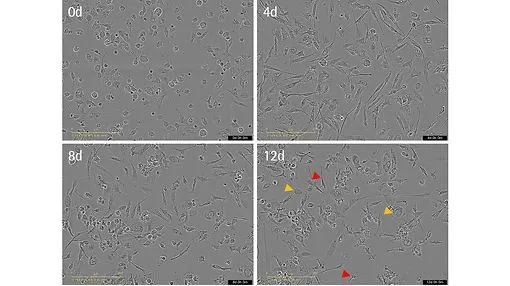 干货分享 | 神经细胞表型分析必读