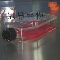 SK-ES1 Cells;肉瘤活化克隆细胞|STR鉴定图谱