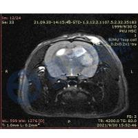 脑胶质瘤动物模型