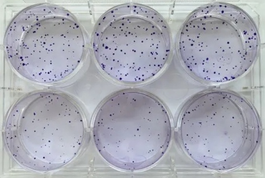 平板克隆实验具体过程