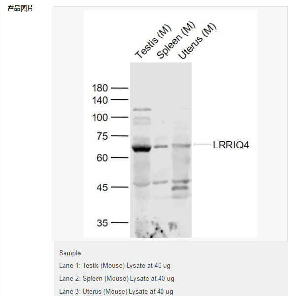 富含亮氨酸重复蛋白Q4抗体