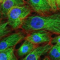 RPMI2650细胞 RPMI2650细胞 RPMI2650细胞