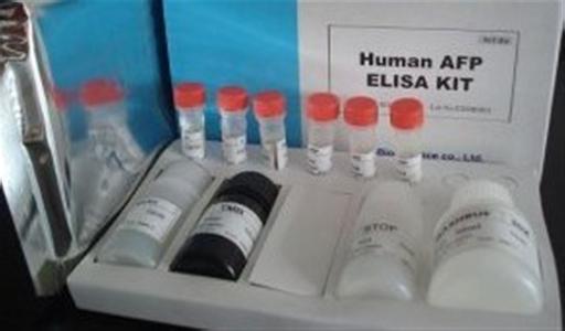 自然抗性相关巨噬细胞蛋白2试剂盒洗涤方法