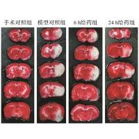 心肌缺血/脑缺血动物模型