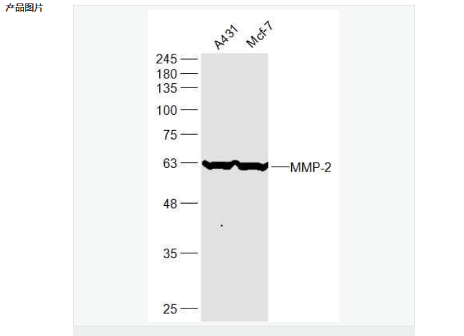 基质金属蛋白酶2抗体