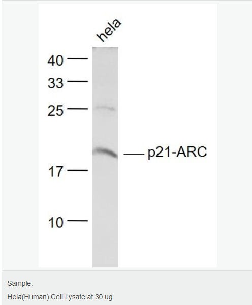肌动蛋白相关蛋白2/3复合物亚基3抗体