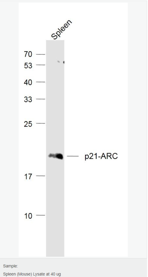 肌动蛋白相关蛋白2/3复合物亚基3抗体