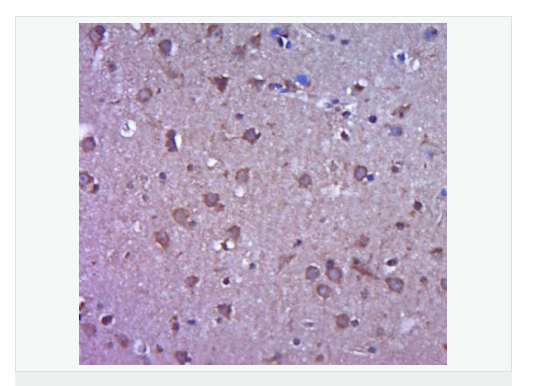 基质金属蛋白酶2抗体