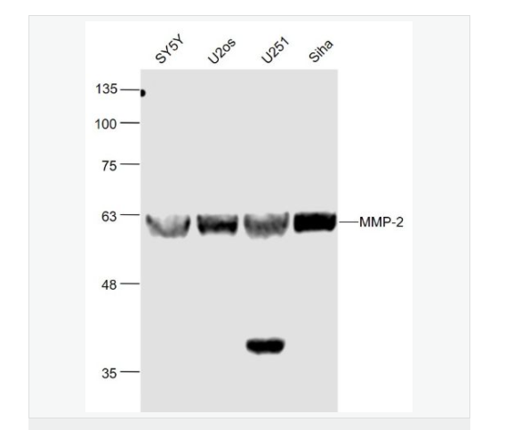 基质金属蛋白酶2抗体