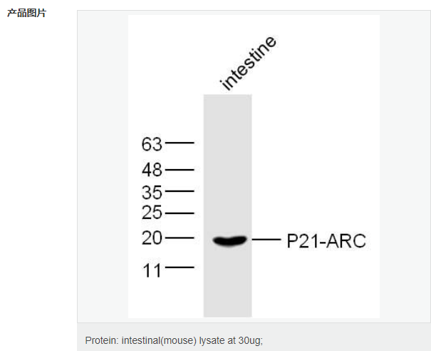 肌动蛋白相关蛋白2/3复合物亚基3抗体