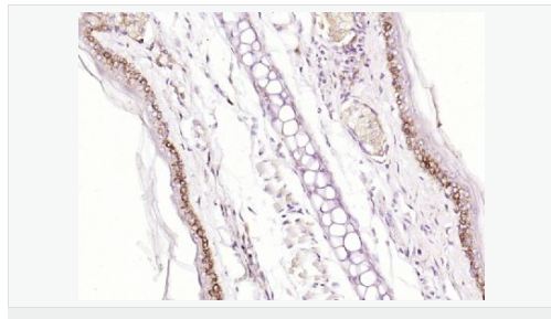 肌动蛋白相关蛋白2/3复合物亚基3抗体