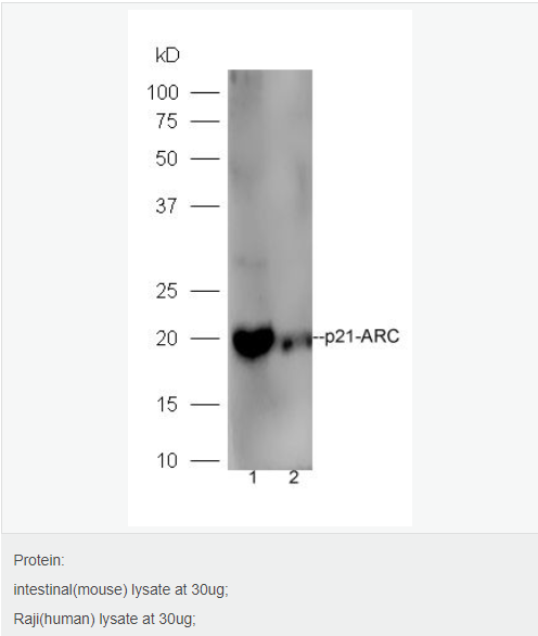 肌动蛋白相关蛋白2/3复合物亚基3抗体