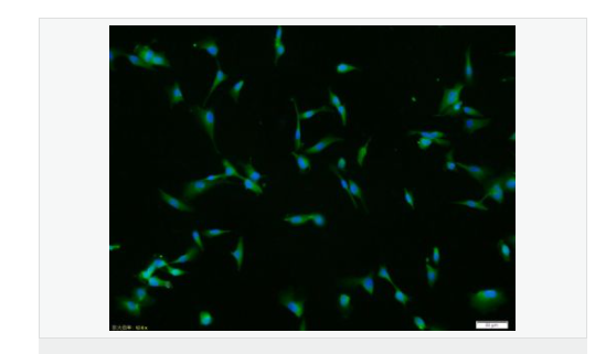 基质金属蛋白酶2抗体