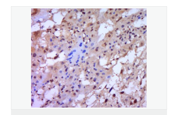 基质金属蛋白酶2抗体