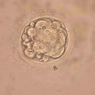 人胚胎干细胞