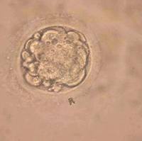 HES 人胚胎干细胞