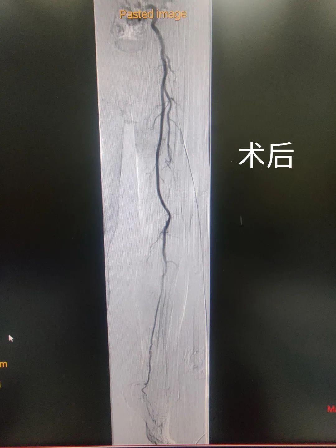 做这个手术前，家属准备了 11 个问题